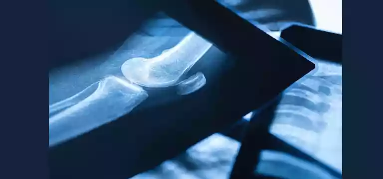 Preparing for a Leg MRI Scan: A Detailed Overview